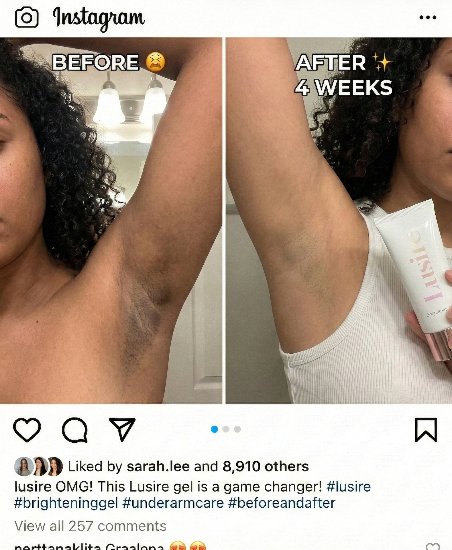 Underarm results - Before and After