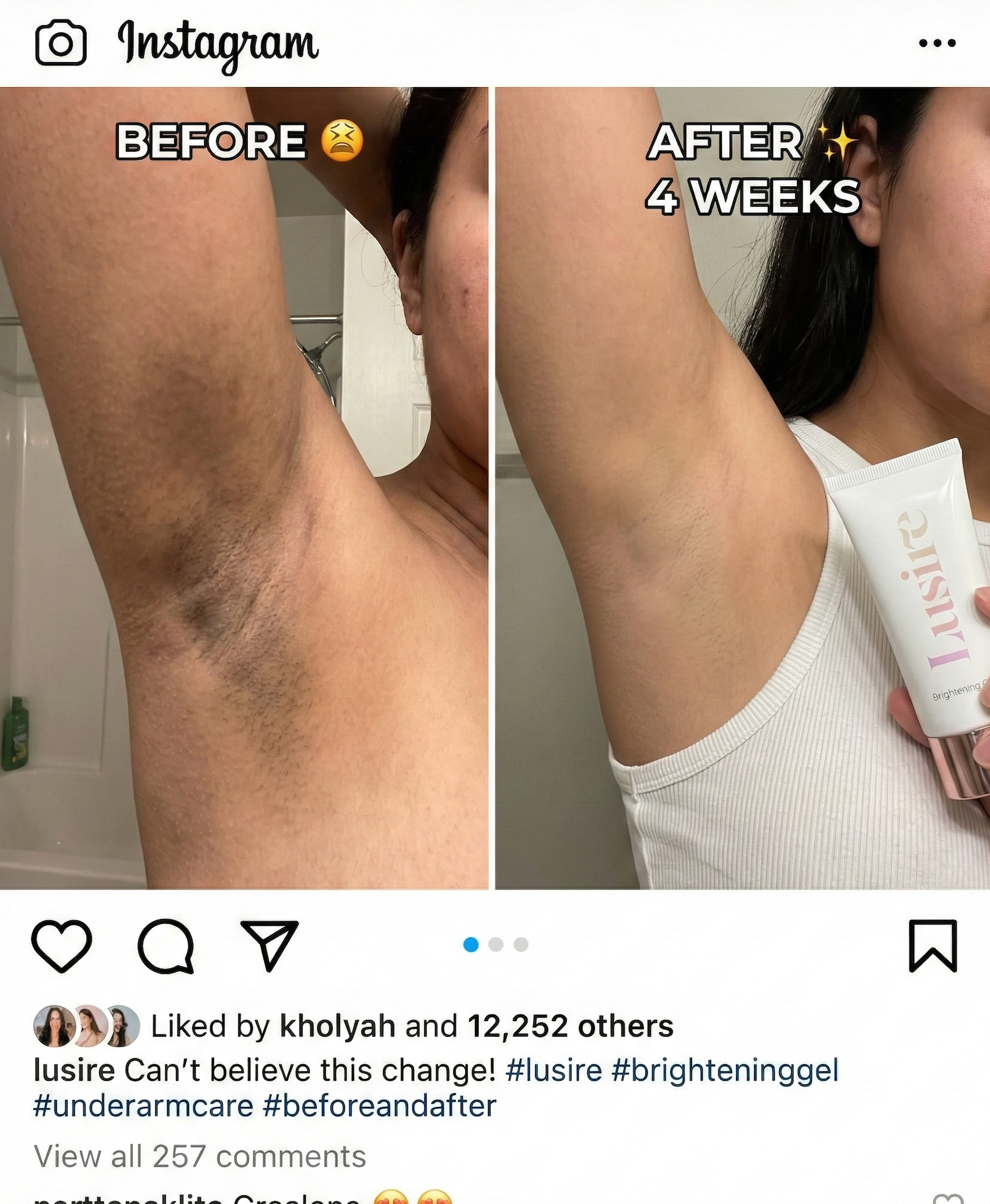 Underarm results - Before and After