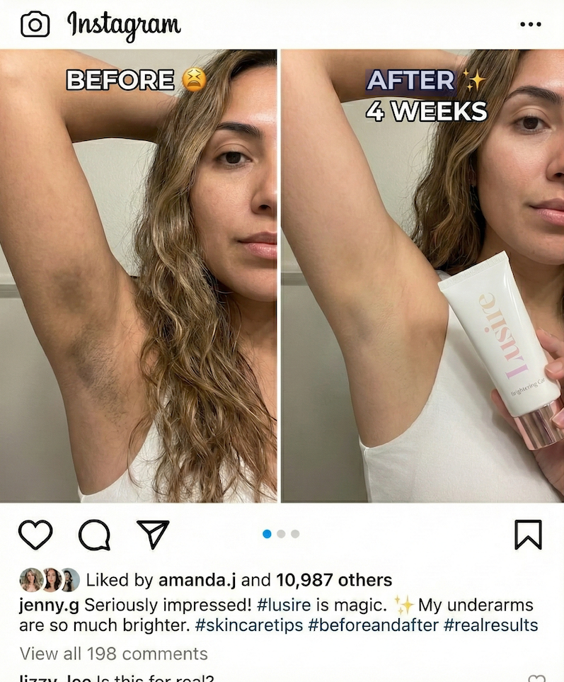 Underarm results - Before and After