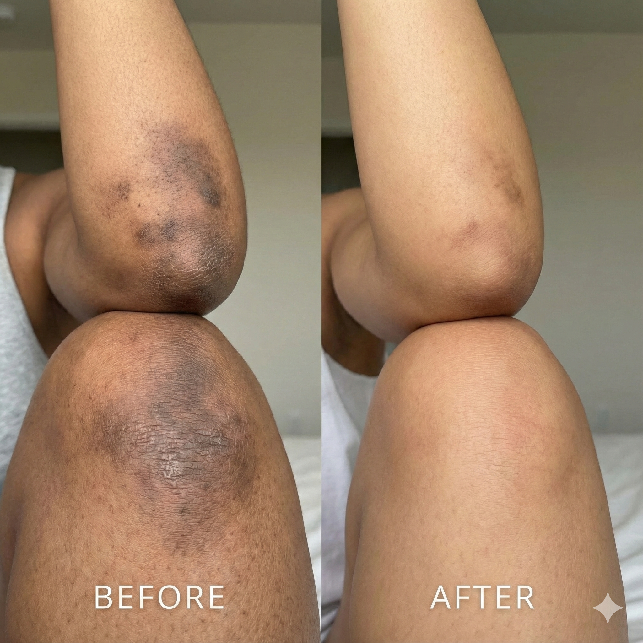 Elbow and knee results - Before and After