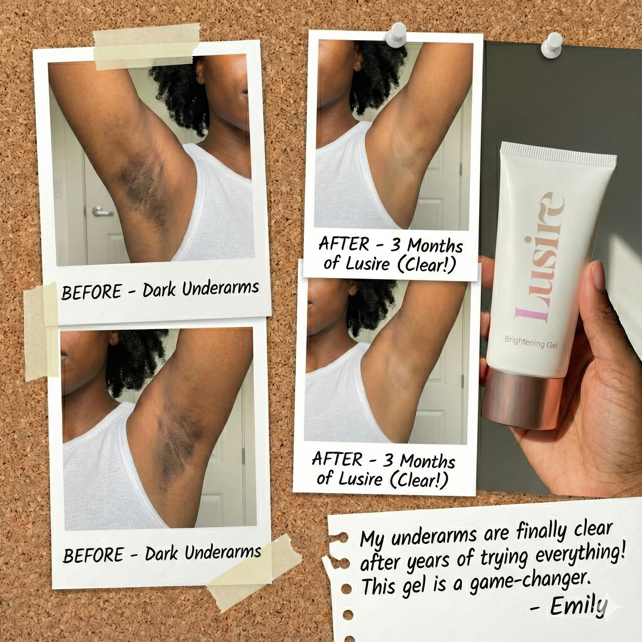 Underarm results - Before and After